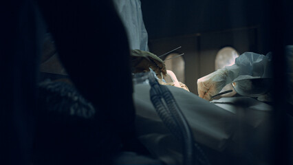 Medical team hands performing operation using sterile surgical tools close up.