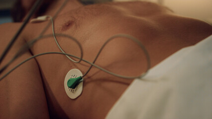 Cardiologist put sensors on patient skin preparing heart cardiogram close up. 