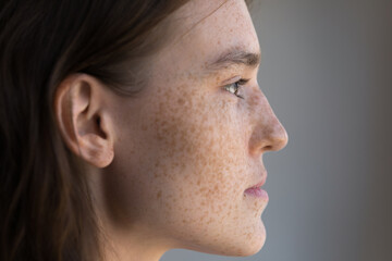 Thoughtful freckled teenage girl facial close up side portrait. Pretty young model woman clean face with fresh clean spotted skin looking away, thinking. Natural beauty, skincare, cosmetology concept - obrazy, fototapety, plakaty