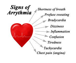 Nine Sign of Arrythmia