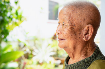 side view asian senior man,old age man with freckles and wrinkles skin face
