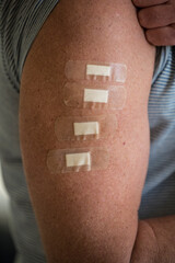 A man's arm with four bandaids, representing four innoculations, including a booster shot.
