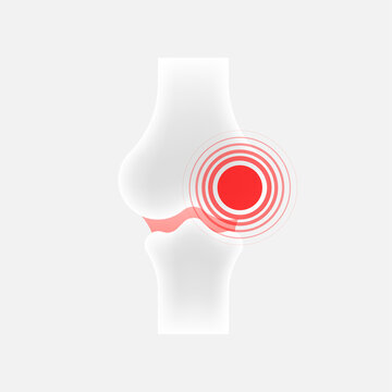 Infographic With Joint Pain. Human Knee Bone Joint Line Icon