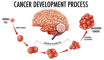 Diagram showing cancer development process
