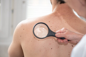 Dermatologist examining the skin of a patient