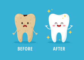 Before and after dental cleaning or whitening and treatment, flat vector illustration on blue background. - obrazy, fototapety, plakaty