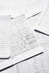 Electroencephalogram diagnostic rezults after epilepsy. Brain wave patterns on EEG.