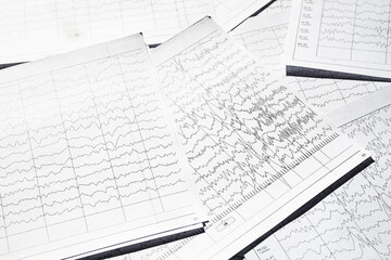 Electroencephalogram diagnostic rezults after epilepsy. Brain wave patterns on EEG.