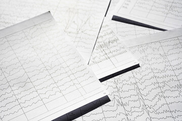 Electroencephalogram diagnostic rezults after epilepsy. Brain wave patterns on EEG.
