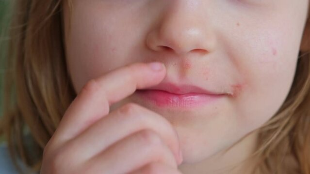 Young Caucasian Girl Picking Nose with Index Finger Front