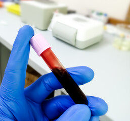 Scientist or techinician hold levender tube with blood sample for hematological or whole blood test.