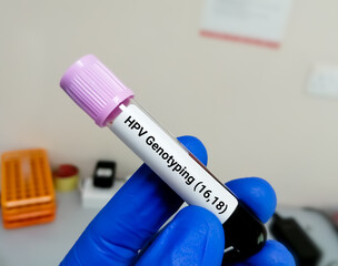 Blood sample for Human papillomavirus (HPV) genotyping testing in PCR laboratory