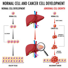 Diagram showing normal and cancer cell