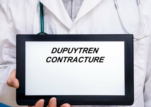Dupuytren Contracture.  Doctor with rare or orphan disease text on tablet screen Dupuytren Contracture