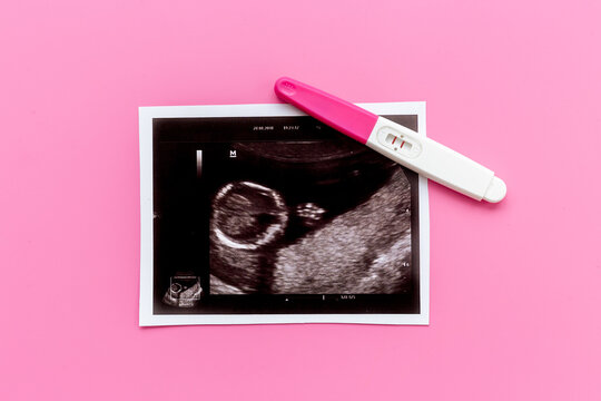 Positive pregnancy test with ultrasound picture of unborn baby