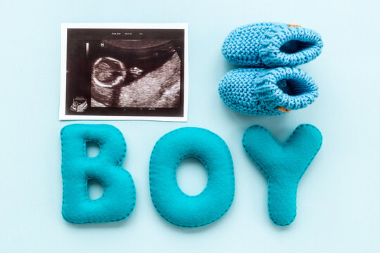Baby boy. Prenatal ultrasound screening of unborn baby with letters boy
