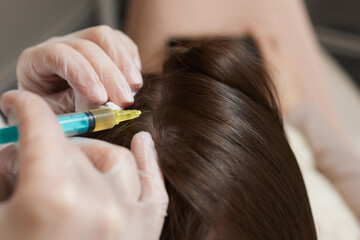 Plasma treatment, plasmolifting or PRP method point the introduction of the patient's own plasma...