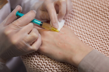 Doctor doing stem cell therapy on a patient's elbow after the injury. Treating knee pain with...