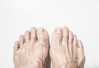 Obraz premium Rough wrinkled feet of an elderly man on a white background