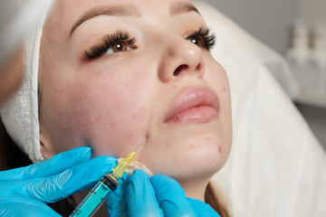 Syringe with a patient's blood plasma in a cosmetologist's hand for a plasmolifting of a woman's...