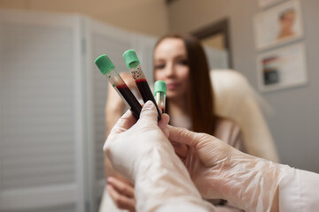 Plasma treatment, plasmolifting or PRP method point the introduction of the patient's own plasma...