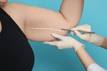 Doctor with scalpel near obese woman on light blue background, closeup. Weight loss surgery