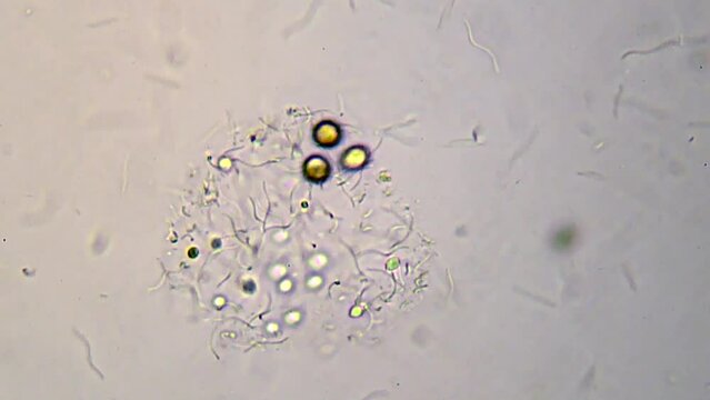 microorganisms in a drop of water from a freshwater lake