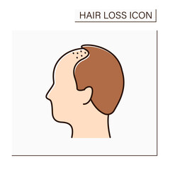 Hair loss color icon. Man loses hair. Male pattern baldness. Alopecia concept. Isolated vector illustration
