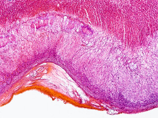 cat adrenal gland cross section under the microscope showing adipose tissue, fibrous capsule, cortex and medulla - optical microscope x100 magnification
