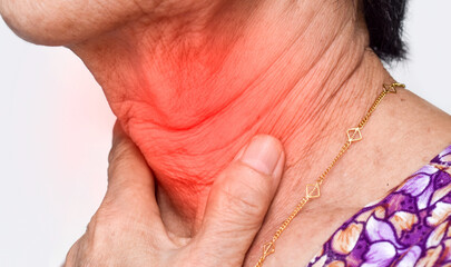 Redness at neck of Asian man. Concept of sore throat, pharyngitis, laryngitis, thyroiditis, or...