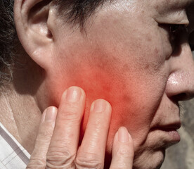 Fototapeta premium Inflammation at the cheek of Asian patient. He feels toothache.