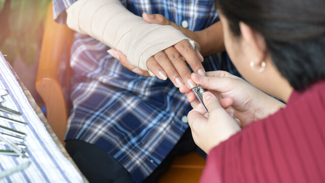 Asian man gets accident to fracture broken arm recuperate at home, while a woman is taking care of cutting her nails