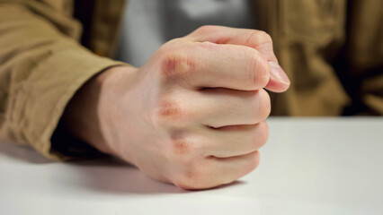 Angry man gets irritated during hard working day. Male employee in mustard jacket hits white table surface with fist sitting in office, close up