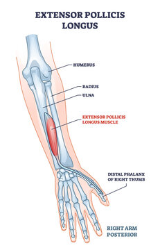 Extensor pollicis longus muscle location with arm skeleton outline diagram. Labeled educational scheme with human hand bones description vector illustration. Physiological muscular system with palm.