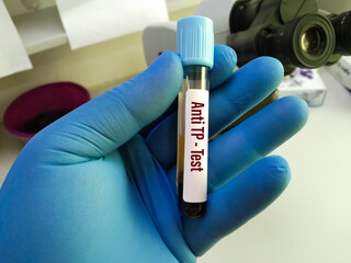 Hand holding blood sample in vacuum tube for pathological analysis. Various laboratory disease...