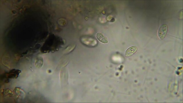 Micro organisms ciliates moving in dirty water, microscope magnification 40X
