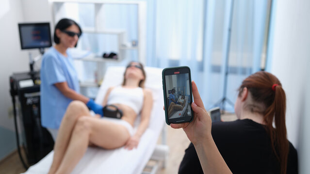 Smm manager filming laser hair removal video on mobile phone for social media ads closeup