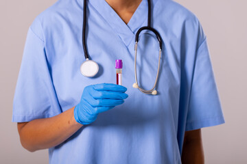 Midsection of african american mid adult female doctor wearing glove holding test tube with blood