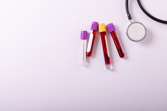Directly above shot of blood samples in test tubes and stethoscope over white background, copy space