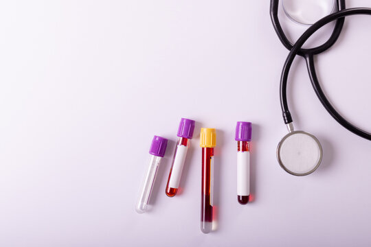 Directly above shot of stethoscope and test tubes with blood samples on white background, copy space