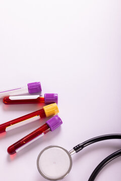 Overhead view of test tubes with blood samples and stethoscope on white background, copy space