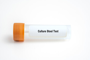Culture Stool Test