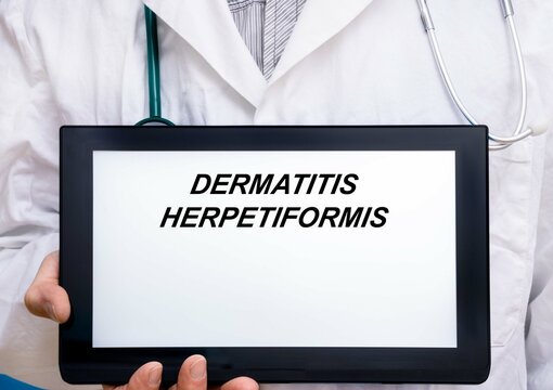 Dermatitis Herpetiformis.  Doctor with rare or orphan disease text on tablet screen Dermatitis Herpetiformis