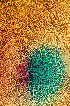 The tissue of a biological organism is affected by two types of cancer cells. Electron microscopy. Concept image of mutational processes under the influence of mutagens