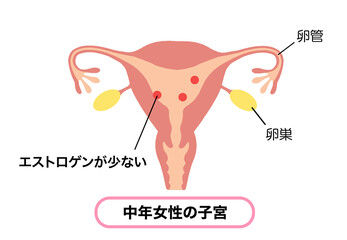 エストロゲンが少ない、中年女性の子宮イラスト