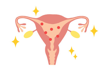 Illustration of a young woman's uterus with high estrogen levels.