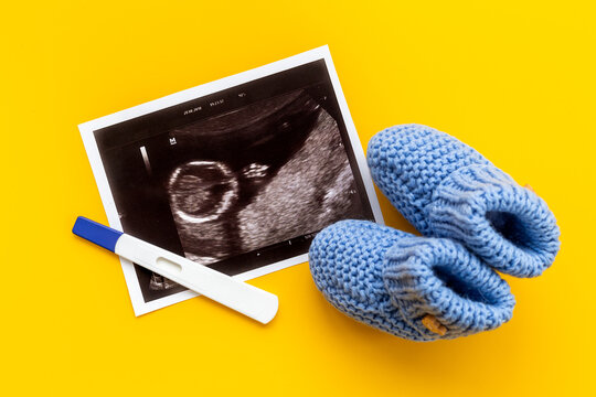 Newborn booties and prenatal ultrasound screening of unborn baby