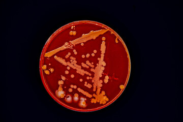 Petri dish with colonies of bacteria in a microbiology laboratory