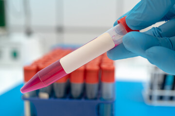Test tube with empty label  to biological sample for medical laboratory research   on lab props...