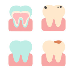 Vector set of teeth in different states. Flat illustration